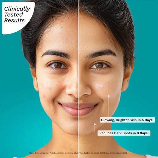 10% Vitamin C Face Serum For Daily Brightness - 30ml